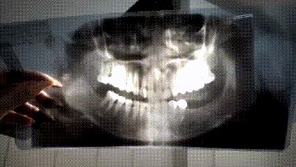 24010702060121b3e.gif